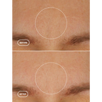 BIORETINOL MOISTURIZER