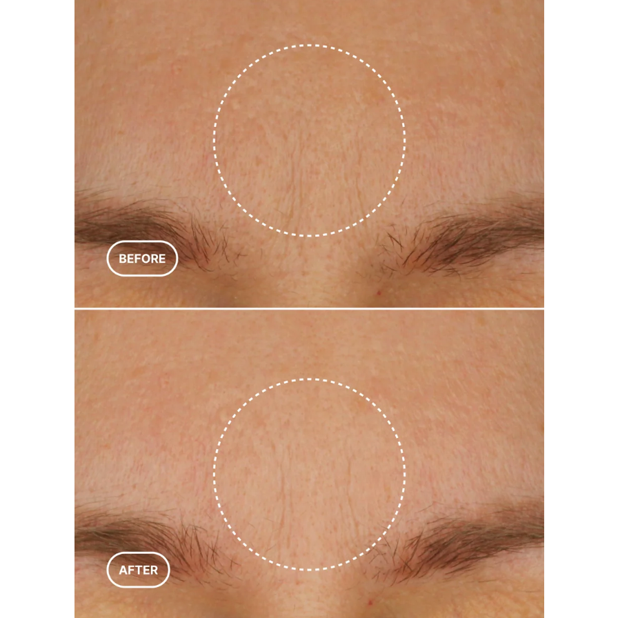 BIORETINOL MOISTURIZER