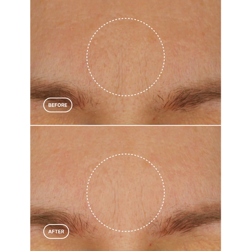 BIORETINOL MOISTURIZER