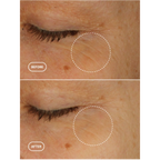 BIORETINOL EYE SERUM