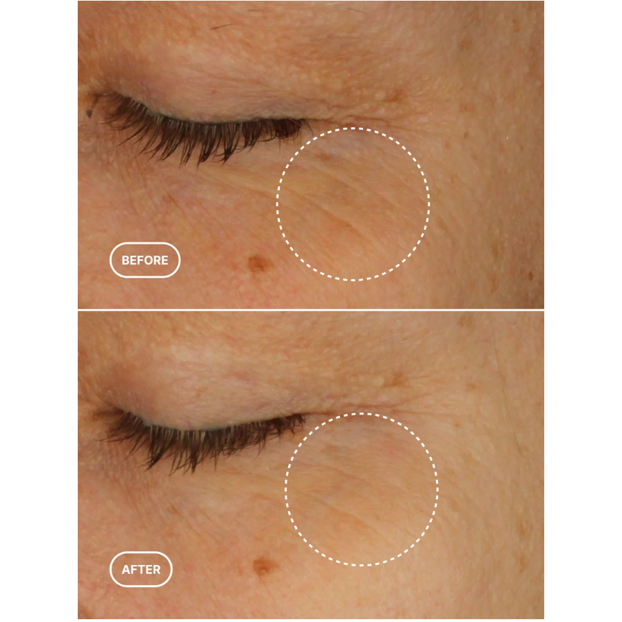 BIORETINOL EYE SERUM