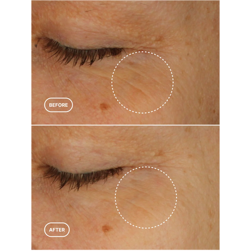 BIORETINOL EYE SERUM